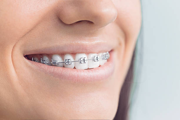 Professional Dental Services in Buffalo, MO